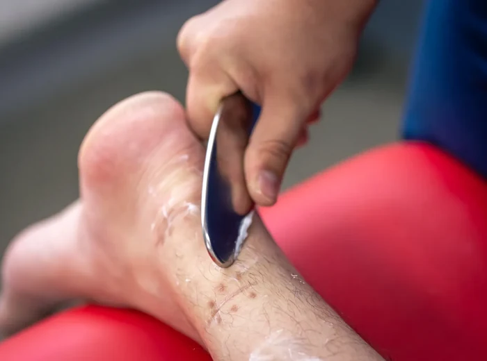 Instrument-assisted soft tissue mobilisation on a patient's leg
